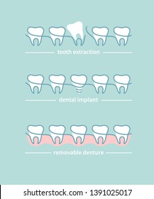 Dentist, orthodontics icons. Tooth restoration concept. Tooth extraction, dental implant, partial removable denture. Trendy flat vector illustration