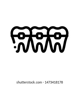 Dentist Stomatology Teeth Braces Vector Sign Icon Thin Line. Teeth Braces Bracket, Orthodontic Appliance Linear Pictogram. Chairside Assistance Dental Health Service Monochrome Contour Illustration