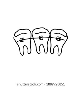 Dentist Stomatology Teeth Braces Vector Sign Icon Thin Line. Teeth Braces Bracket, Orthodontic Appliance Linear Pictogram. Chairside Assistance Dental Health Service Monochrome Contour Illustration