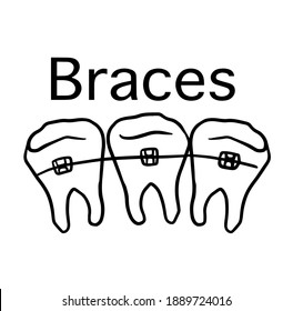 Dentist Stomatology Teeth Braces Vector Sign Icon Thin Line. Teeth Braces Bracket, Orthodontic Appliance Linear Pictogram. Chairside Assistance Dental Health Service Monochrome Contour Illustration