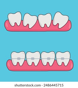 Herramientas dentales, herramientas dentales, salud dental, Ilustración vectorial dental