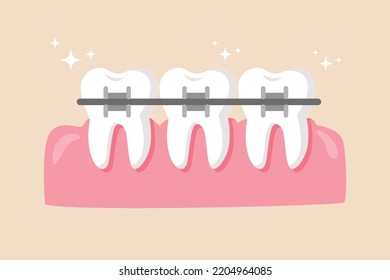 Dentist who put braces on the people gum. Dentist concept. Colored flat vector illustration.