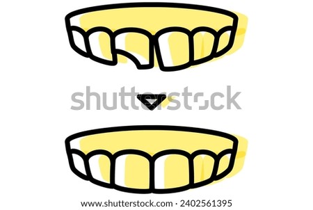 Dentistry: Direct Bonding Before and After, Simple Line Drawing　, Vector Illustration