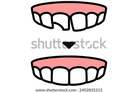 Dentistry: Direct Bonding Before and After, Simple Line Drawing　, Vector Illustration
