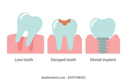 Dentistry, icons set. Lost tooth, decayed tooth, implant. Medical concept. Vector