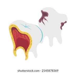 Icono isométrico dental con estructura de dientes deteriorados 3d ilustración vectorial