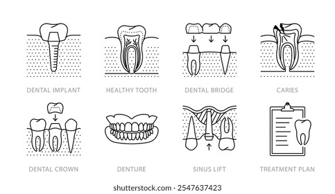 Odontologia, conjunto de ícones de linha. Implante dentário, dente, cárie, ponte dentária, coroa, dentaduras, elevação do seio nasal. Odontologia e tratamento de dentes tópico. Cirurgia oral. Ilustração linear, ícone de traçado editável