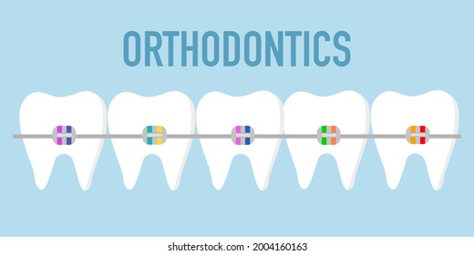 Dentistry and orthodontics concept vector illustration. Dental braces in flat design.