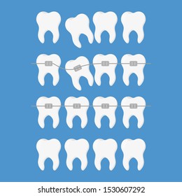 dentistry set illustration, align teeth braces flat style