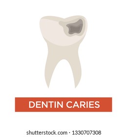 Dentista daño dental caries dental estadio cuidado dental aislado vectores no sanos dientes cavidad de boca y destrucción de mandíbula medicina de higiene oral y enfermedad de la salud o dolores de dientes sintomáticos