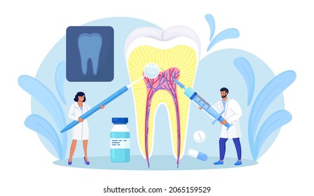 Dentists cleaning and treating big unhealthy tooth with caries cavity. Toothache. Stomatology, Dentistry concept. Doctors with professional instruments for check up and treatment. Dentist appointment