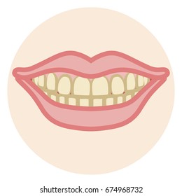 Dentition - Stain