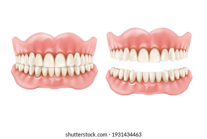 Denture, dental teeth and jaw, realistic prosthesis, vector tooth and mouth. Removable denture mockup for dentistry medicine, teeth whitening, dental medical prosthetic and orthodontic or implantation