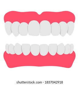 Denture teeth vector cartoon illustration isolated on a white background.