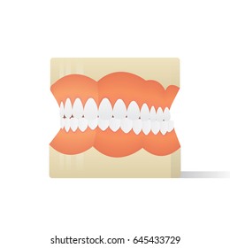 Dentures model illustration vector on white background. Medical concept.