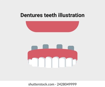 Dentures teeth flat illustration. Dentistry and orthodontics vector illustration. Dental clinic services, stomatology, dentistry, orthodontics, oral health care and hygiene vector.