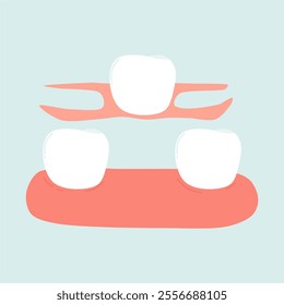 Dentures for Tooth Loss Cases