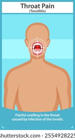 Depicts throat pain caused by tonsil infection