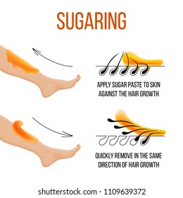 Depilation and sugaring. Hair removal. Epilation. follicle. Woman leg with sugar or wax. Before and after. Process and steps of depilation. vector illustration. cosmetology, bodycare and beauty