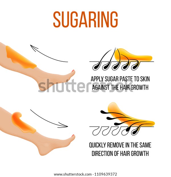 Depilation Sugaring Hair Removal Epilation Follicle Stock Vector