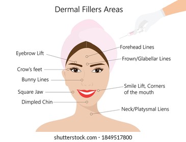 Dermal filler injections areas. Woman face with doctor hands in gloves with syringe. Beauty lifting anti-aging treatment vector illustration.