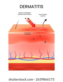 Dermatitis Allergen Ingress and Skin Inflammation