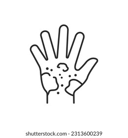 Dermatitis icon. Vector illustration isolated on white. Editable stroke.