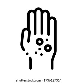 Dermatitis Rash On Hands Icon Vector. Dermatitis Rash On Hands Sign. Isolated Contour Symbol Illustration