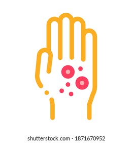 dermatitis erupción en el vector del icono de las manos. dermatitis erupción en las manos, signo. ilustración de símbolo de color
