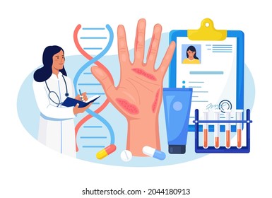 Dermatologist and Big Hand with Red Skin and Rash on Background. Psoriasis, Vitiligo, Dermatitis. Eczema - Inflammation Skin Disease. Consequences of Improper Care, Frequent Hand Washing, Disinfection