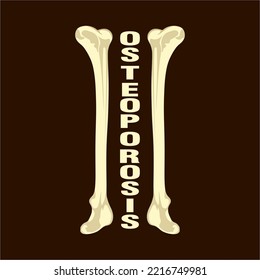 Diseño de los huesos de las piernas con osteoporosis de texto. fondos, símbolos, carteles. vector de diseño