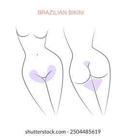 Designated areas hair removal Brazilian bikini, borders for hair removal. Female depilation with wax, laser epilation.