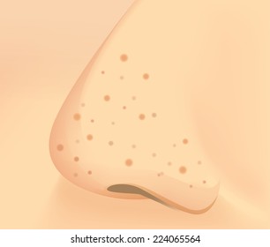 Detail shot skin at nose with problem blackhead