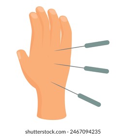 Detailed acupuncture hand model vector illustration for educational clinical practice and therapeutic procedure in alternative chinese medicine therapy