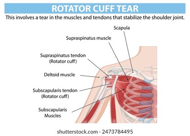 Detailed anatomy of shoulder rotator cuff tear