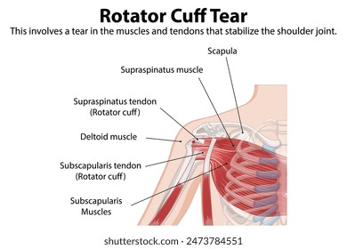 Detailed anatomy of shoulder rotator cuff tear