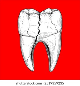 Ilustração detalhada em preto e branco de um dente molar rachado em um fundo vermelho arrojado, perfeito para desenhos dentários ou relacionados à saúde, materiais educacionais ou visuais médicos