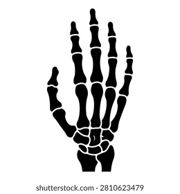 Detailed black and white X-ray image showcasing the skeletal structure of a human hand with clear bone details.
