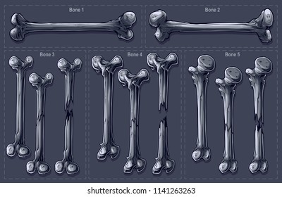 Detailed graphic realistic black and white different isolated broken human bones. On gray background. Vector icon set.