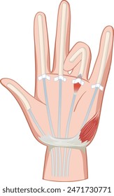 Detailed illustration of hand muscles and tendons