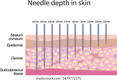 Detailed Illustration of Needle Insertion Depth in Skin During Microneedling and Cosmetology Procedure