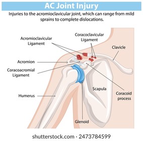 Detailed illustration of shoulder joint anatomy