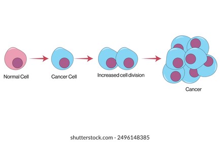 Ilustración vectorial detallada de la formación normal de células cancerosas, diagrama de metástasis sobre fondo blanco.