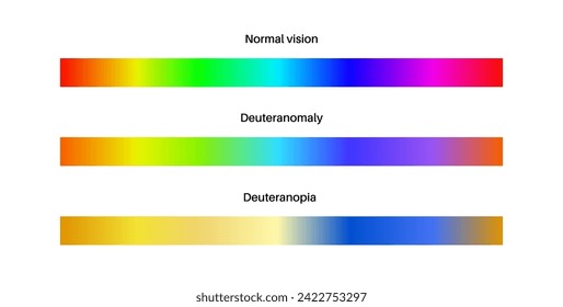 Deuteranomaly, deuteranopia and normal vision, color blindness infographic. Human vision deficiency concept. Difference between colors, brightness and intensity of shades flat vector illustration