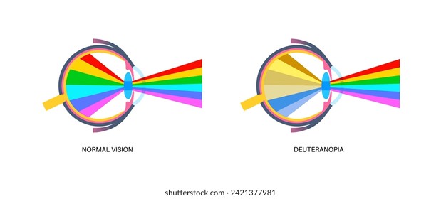 Deuteranopia and normal vision, color blindness infographic. Human vision deficiency concept. Difference between colors, brightness and intensity of shades flat vector illustration
