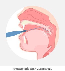 Symbol einer tonsilen Operation zur Entfernung der Anatomie der Infektion