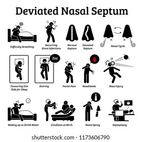 Deviated nasal septum icons. Illustrations depict signs and symptoms of nose problem. Difficulty breathing, sinus infection, snoring, and facial pain. Treatments are nasal spray and septoplasty.