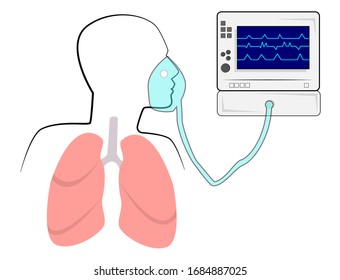 The device of artificial ventilation of the lungs working on schematic lungs.