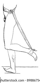A device extension of the foot and flexion of the leg for tendon rupture, of Achilles, vintage engraved illustration. Usual Medicine Dictionary by Dr Labarthe - 1885