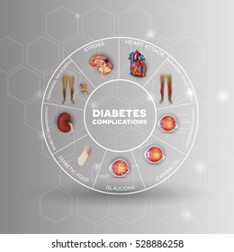 Diabetes affected areas info graphic wheel. Diabetes affects nerves, kidneys, eyes, vessels, heart and skin.
